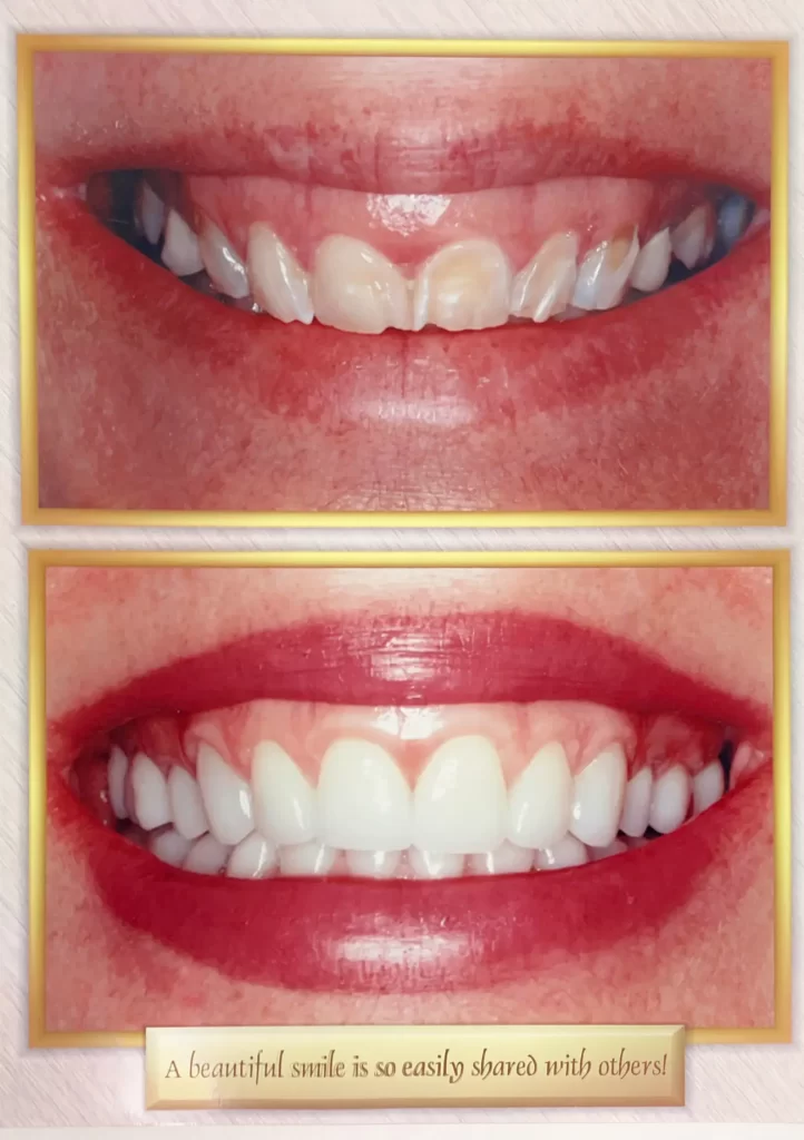 Before and after dental treatment from Dr. Gropp