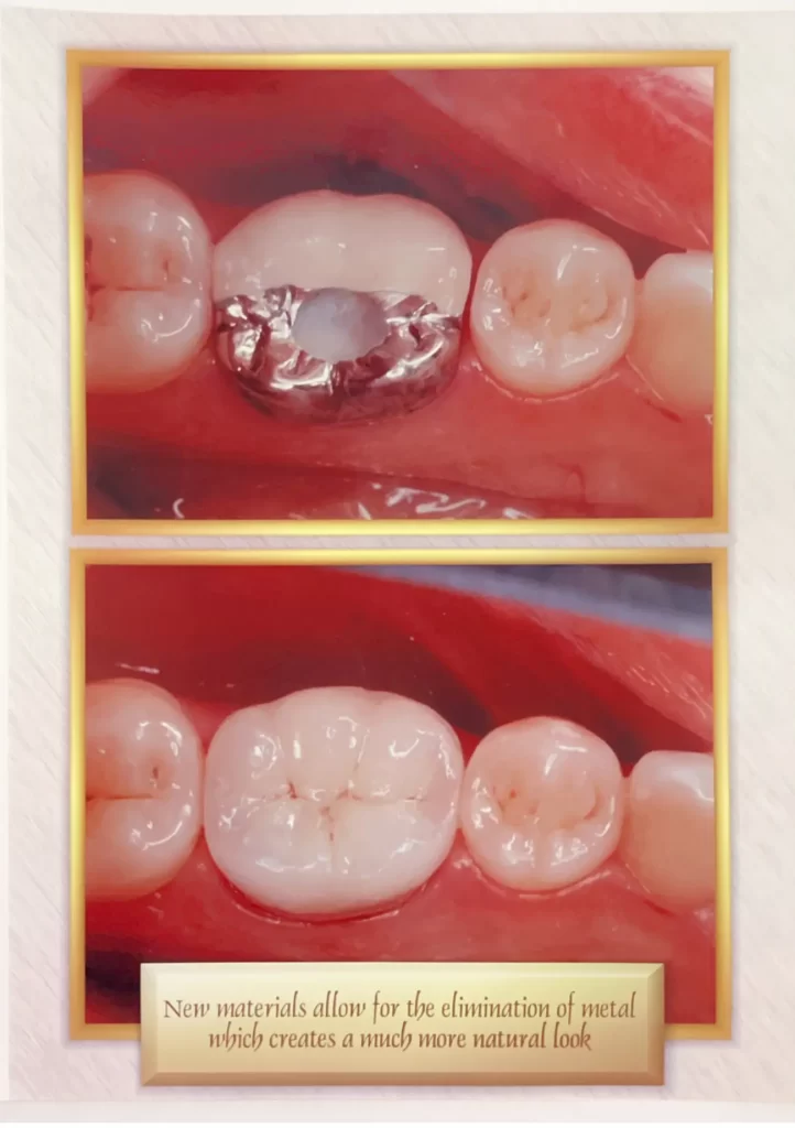 Before and after dental treatment from Dr. Gropp