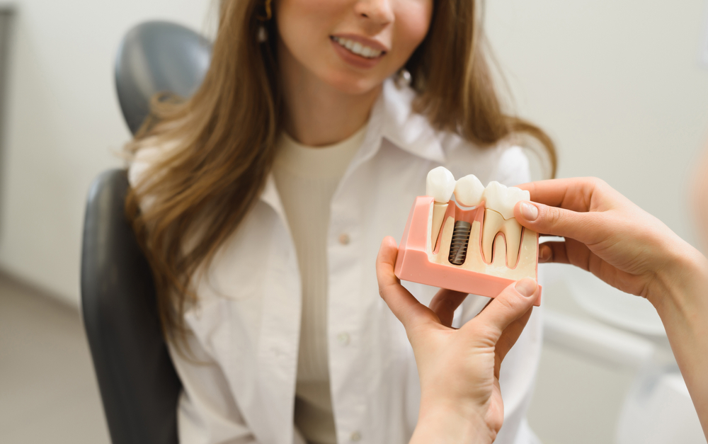 What To Know Before Getting Dental Implants