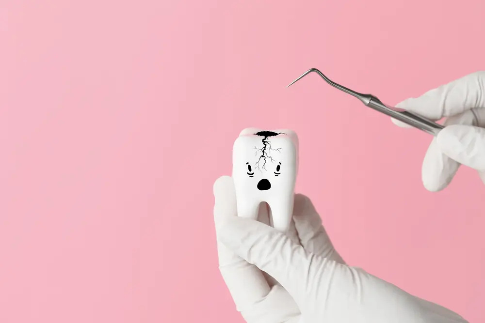Cracked tooth
