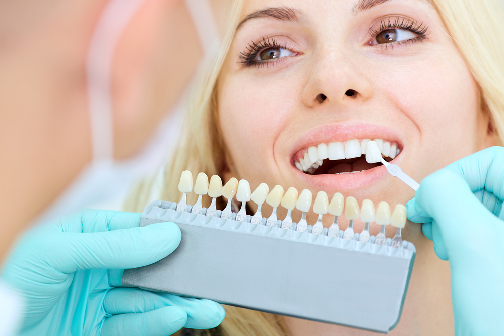 patient choosing her shade of porcelain veneers