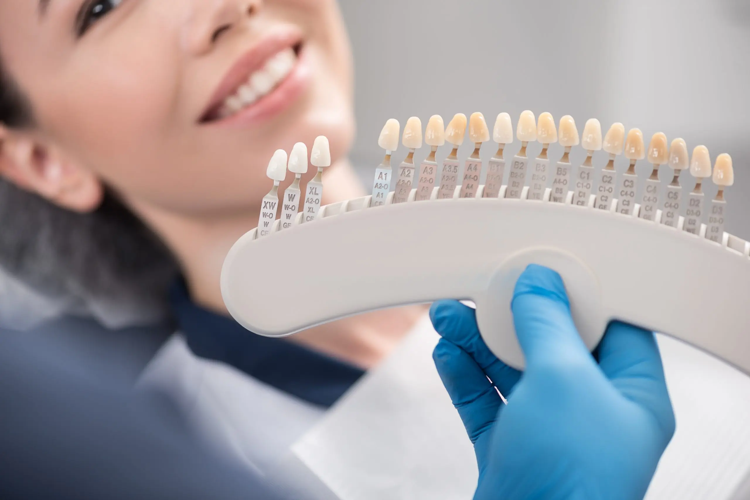 porcelain veneers